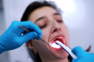 intraoral scanners